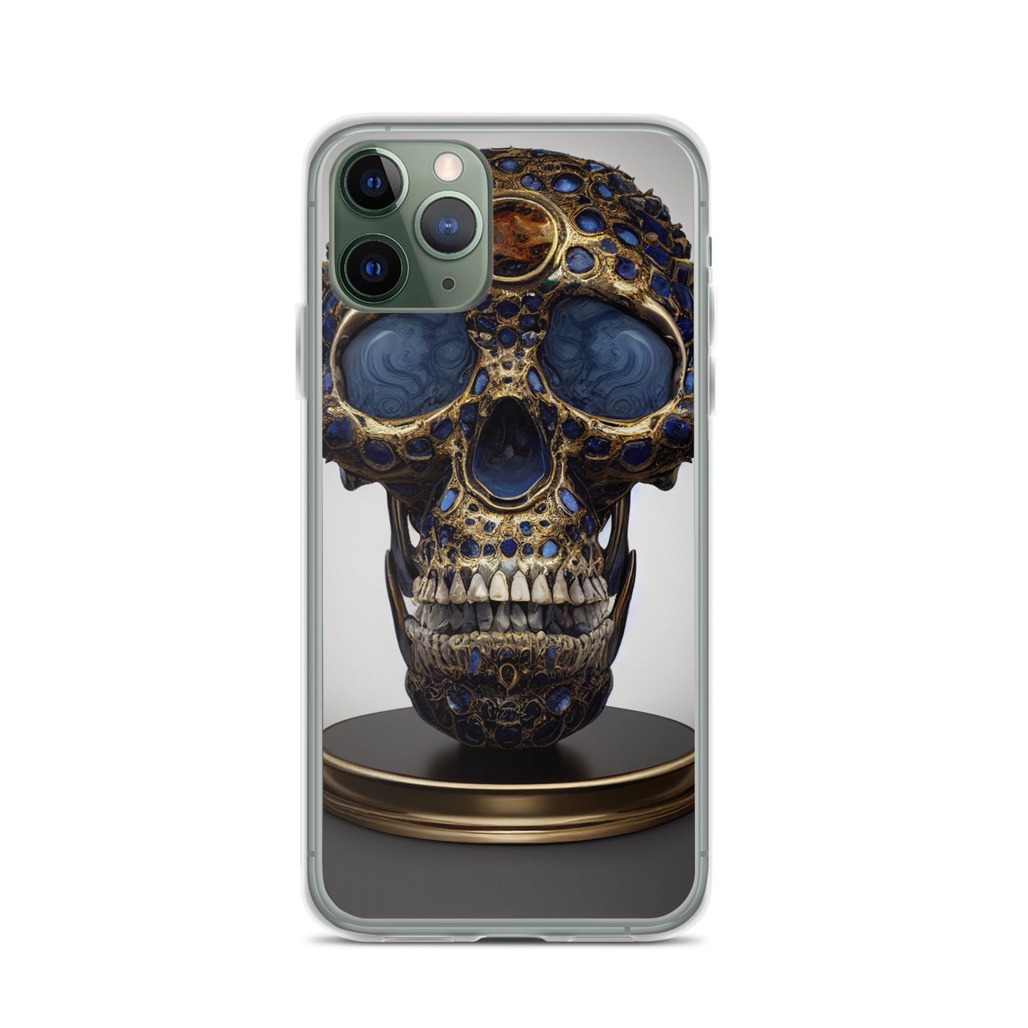 iPhone Case - Golden Skull