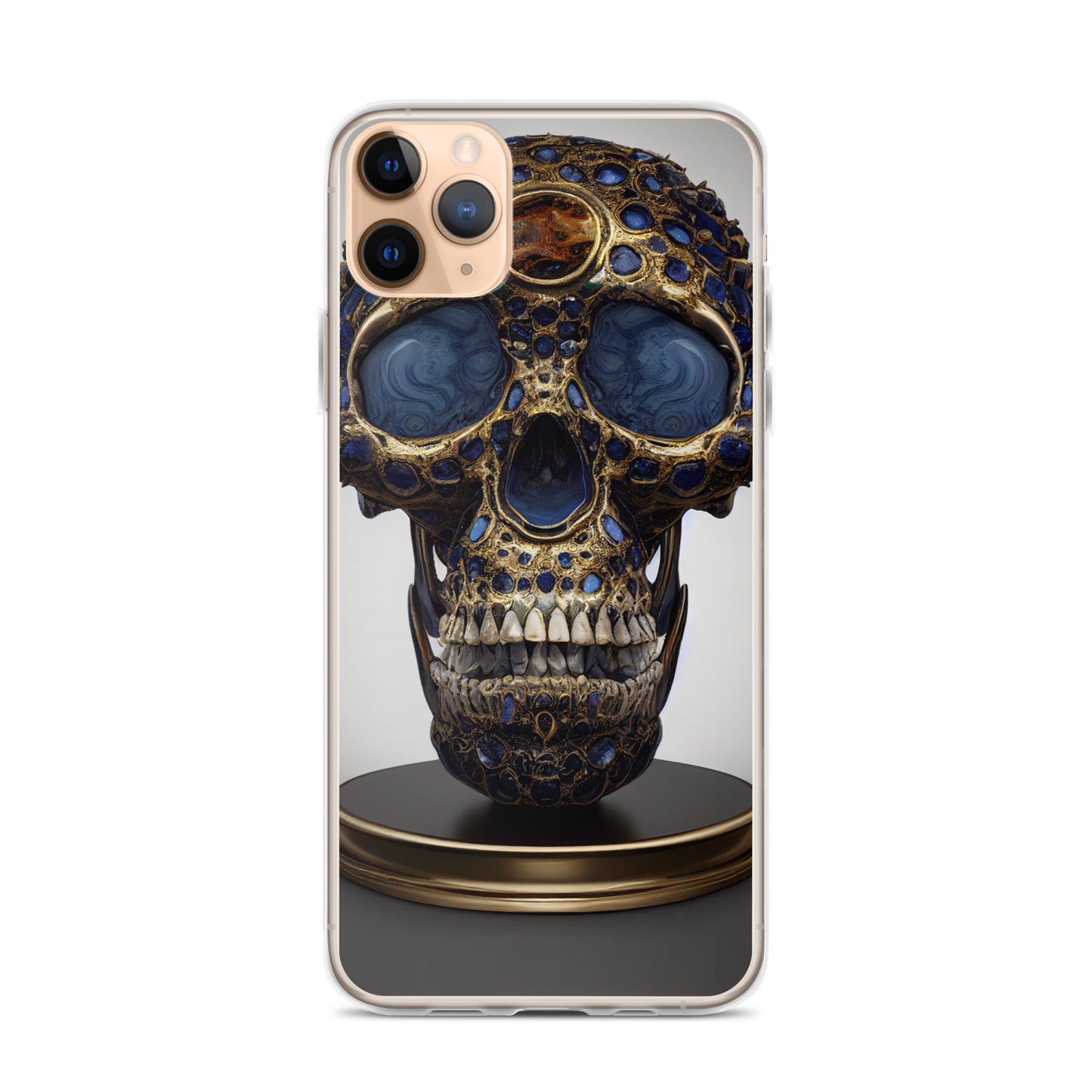 iPhone Case - Golden Skull