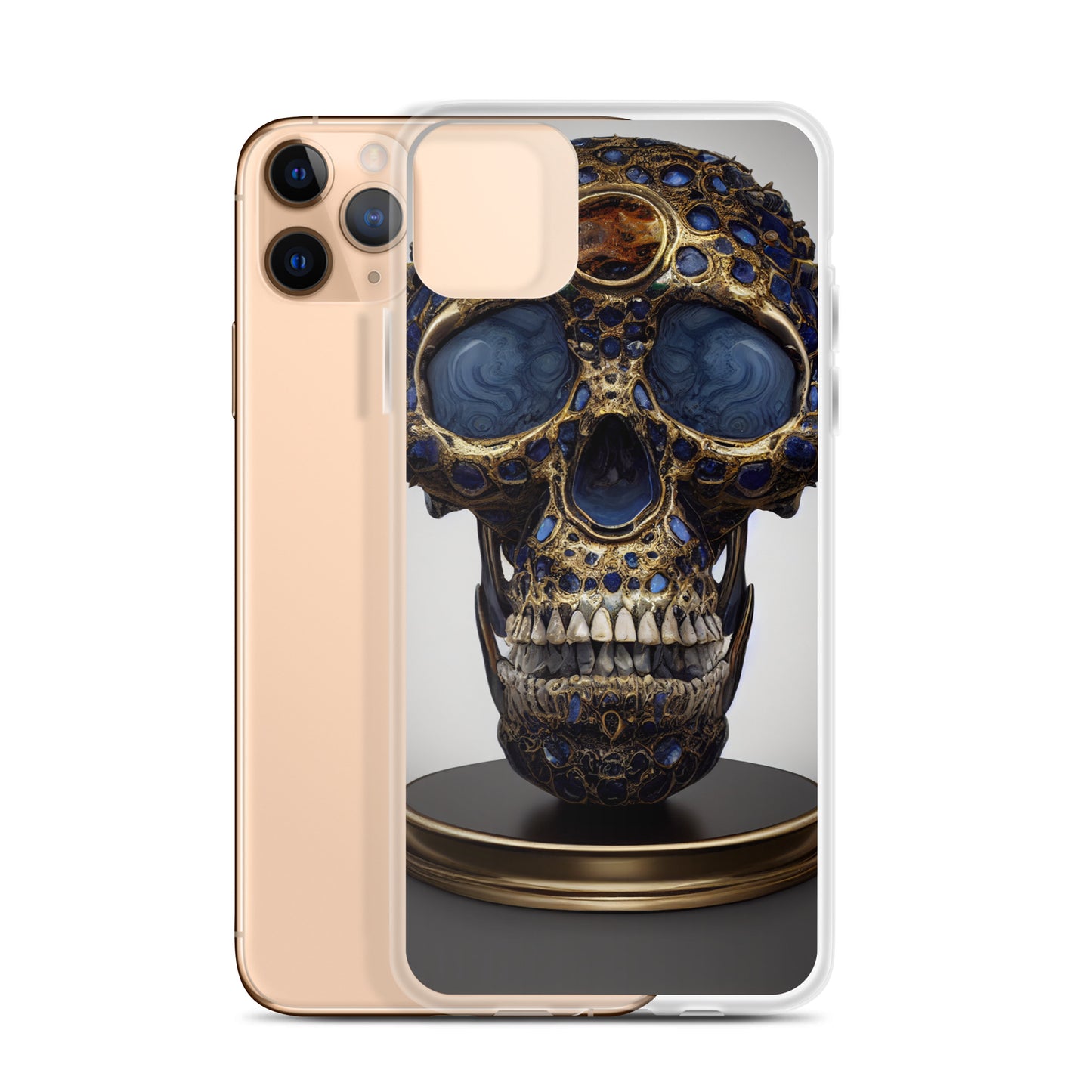 iPhone Case - Golden Skull