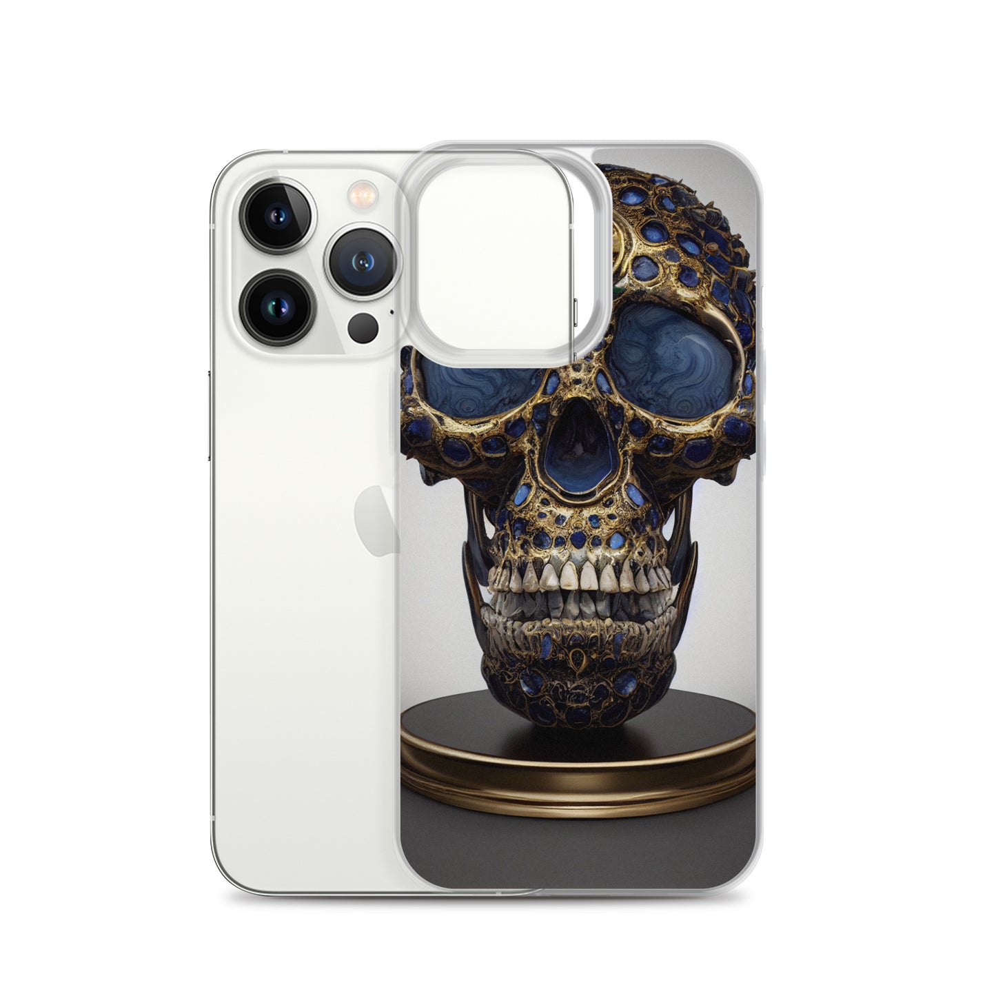 iPhone Case - Golden Skull